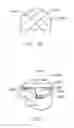 Fig. 07 - Intervertebral implant