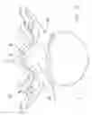Fig. 06 - Multiple facet joint replacement