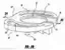 Fig. 11 - Artificial intervertebral disc
