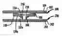 Fig. 01 - Intervertebral spacer device