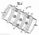 Fig. 02 - Intervertebral spacer device