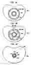Fig. 05 - Intervertebral spacer device