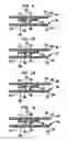 Fig. 06 - Intervertebral spacer device