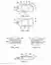Fig. 06 - Posterior spinal arthroplasty-development of a new posteriorly inserted artificial disc, a new anteriorly inserted artifical disc and an artificial facet joint