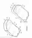 Fig. 09 - Posterior spinal arthroplasty-development of a new posteriorly inserted artificial disc, a new anteriorly inserted artifical disc and an artificial facet joint