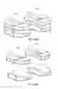Fig. 12 - Posterior spinal arthroplasty-development of a new posteriorly inserted artificial disc, a new anteriorly inserted artifical disc and an artificial facet joint