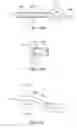Fig. 17 - Posterior spinal arthroplasty-development of a new posteriorly inserted artificial disc, a new anteriorly inserted artifical disc and an artificial facet joint