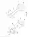 Fig. 26 - Posterior spinal arthroplasty-development of a new posteriorly inserted artificial disc, a new anteriorly inserted artifical disc and an artificial facet joint