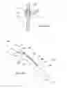 Fig. 27 - Posterior spinal arthroplasty-development of a new posteriorly inserted artificial disc, a new anteriorly inserted artifical disc and an artificial facet joint
