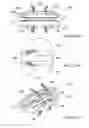 Fig. 30 - Posterior spinal arthroplasty-development of a new posteriorly inserted artificial disc, a new anteriorly inserted artifical disc and an artificial facet joint