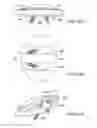 Fig. 32 - Posterior spinal arthroplasty-development of a new posteriorly inserted artificial disc, a new anteriorly inserted artifical disc and an artificial facet joint