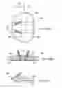 Fig. 33 - Posterior spinal arthroplasty-development of a new posteriorly inserted artificial disc, a new anteriorly inserted artifical disc and an artificial facet joint