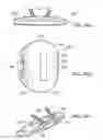 Fig. 34 - Posterior spinal arthroplasty-development of a new posteriorly inserted artificial disc, a new anteriorly inserted artifical disc and an artificial facet joint
