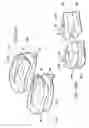Fig. 44 - Posterior spinal arthroplasty-development of a new posteriorly inserted artificial disc, a new anteriorly inserted artifical disc and an artificial facet joint