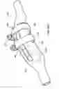 Fig. 47 - Posterior spinal arthroplasty-development of a new posteriorly inserted artificial disc, a new anteriorly inserted artifical disc and an artificial facet joint