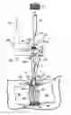 Fig. 01 - Catheter holder for spinal implant