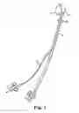 Fig. 02 - Catheter holder for spinal implant