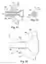 Fig. 13 - Catheter holder for spinal implant