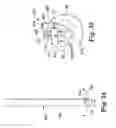 Fig. 16 - Catheter holder for spinal implant