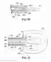 Fig. 17 - Catheter holder for spinal implant