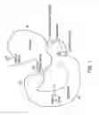 Fig. 02 - Intestinal sleeve