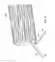 Fig. 10 - Intestinal sleeve