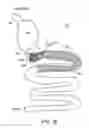 Fig. 33 - Intestinal sleeve