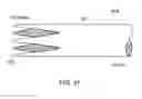 Fig. 34 - Intestinal sleeve