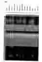 Fig. 04 - Expression profiling of tumours
