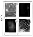 Fig. 05 - Method of growing sperm stem cells in vitro, sperm stem cells grown by the method, and medium additive kit to be used in growing sperm stem cells in vitro