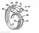 Fig. 01 - Cable retention system