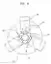 Fig. 07 - Method and apparatus for reducing a stent