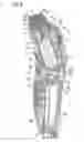 Fig. 07 - Hair cutting device