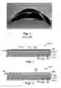 Fig. 02 - Abrasive articles and methods of making and using the same