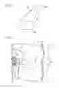 Fig. 04 - Pressure sensor for detecting collision