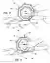 Fig. 04 - Annular octagonal hand held pushing tool for use with cutting and abrasive tools