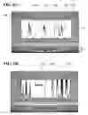 Fig. 11 - System and method for managing sleep disorders