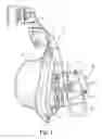 Fig. 02 - Vent cover for a mask assembly