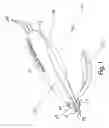 Fig. 02 - Hair weave tract extraction device