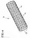 Fig. 07 - Stent-graft with bioabsorbable structural support