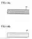 Fig. 15 - Stent-graft with bioabsorbable structural support