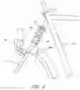 Fig. 09 - Bicycle damping enhancement system