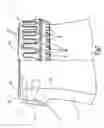 Fig. 02 - Bottle seal