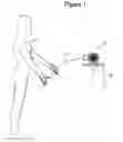Fig. 02 - Band cutting system