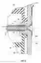 Fig. 07 - Tape measure with post reinforcing collar