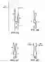 Fig. 05 - Visual display wall mounting apparatus