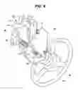 Fig. 05 - Pivot and bearing assembly for a manual valve operator