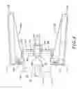 Fig. 05 - Catheter grip