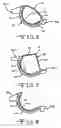 Fig. 06 - Method of agglomerating wet chopped fiber