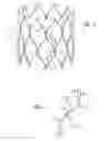 Fig. 02 - Nitinol frame heating and setting mandrel